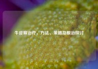 牛皮癣治疗，     、策略及根治探讨